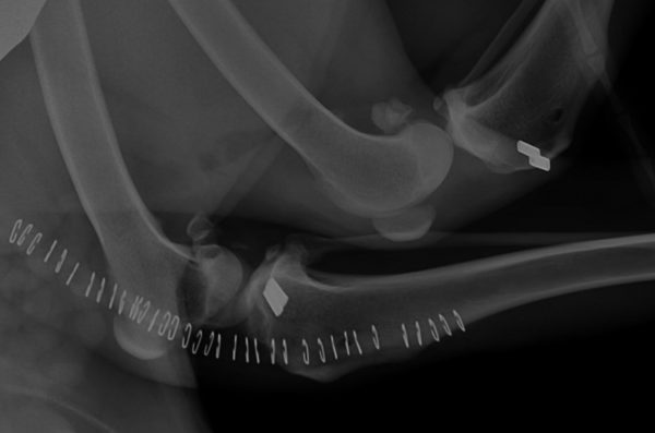 Radiographie d'une rupture du ligament